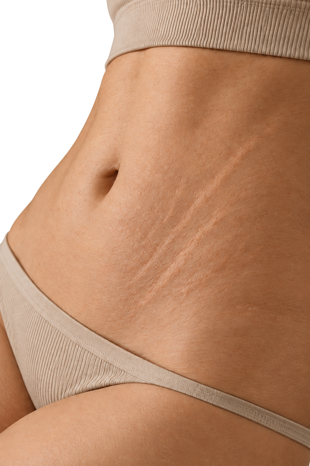 Detalle editorial de abdomen con estrías visibles